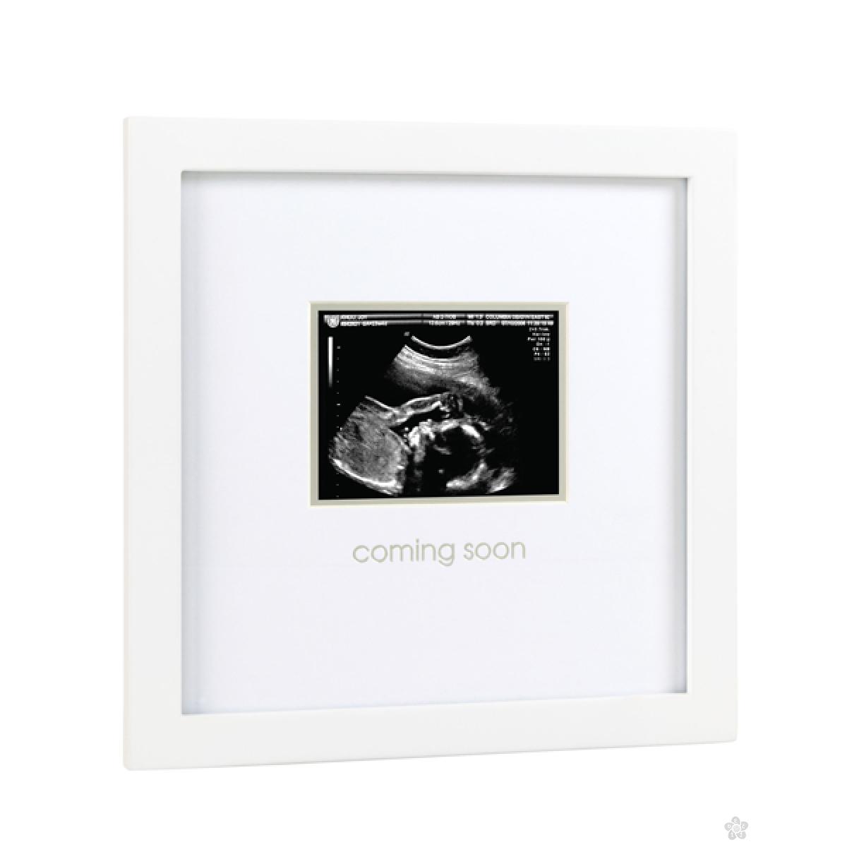 Sonogram zidni ram  P63013 